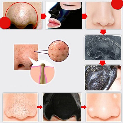 5 Pcs Nose Blackhead Pore Mud Mineral Cleansing Cleaner Removal Membranes Strips