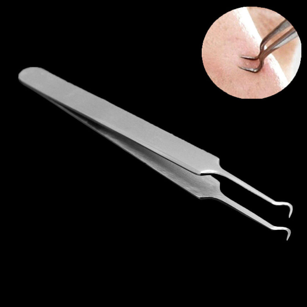 Blackhead Curved Acne Tweezer Remover Tool Pimple Comedone Face Cleaner