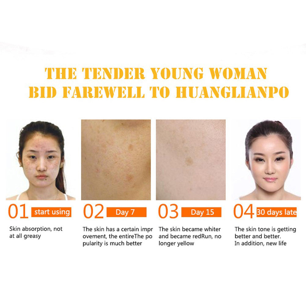 Vitamin C Facial Serum Whitening Brighten Moisturizing Anti-wrinkle Skin Care