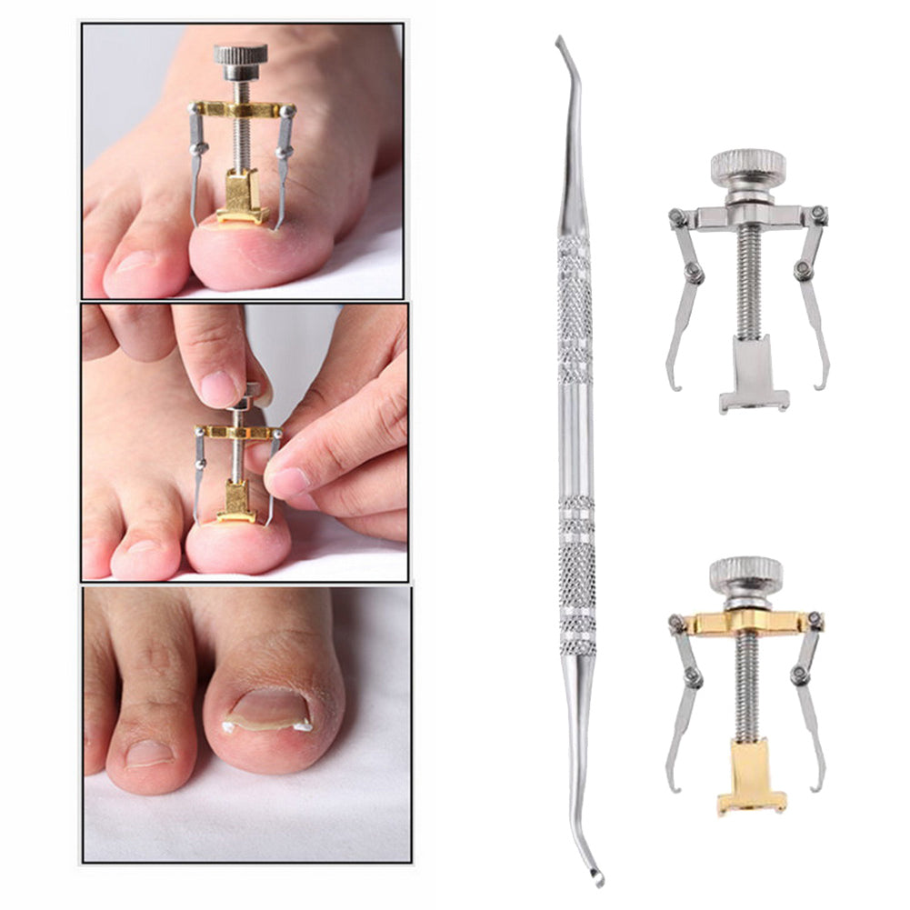 Paronychia Therapy Ingrown Toenail Lifter  and  Correction Tool Pedicure Treatment