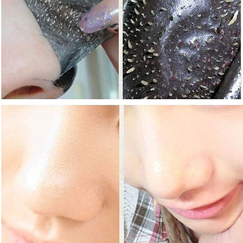 5Pcs Mineral Mud Blackhead Cleaner Remover Nose Membranes Cleansing Pore Strips