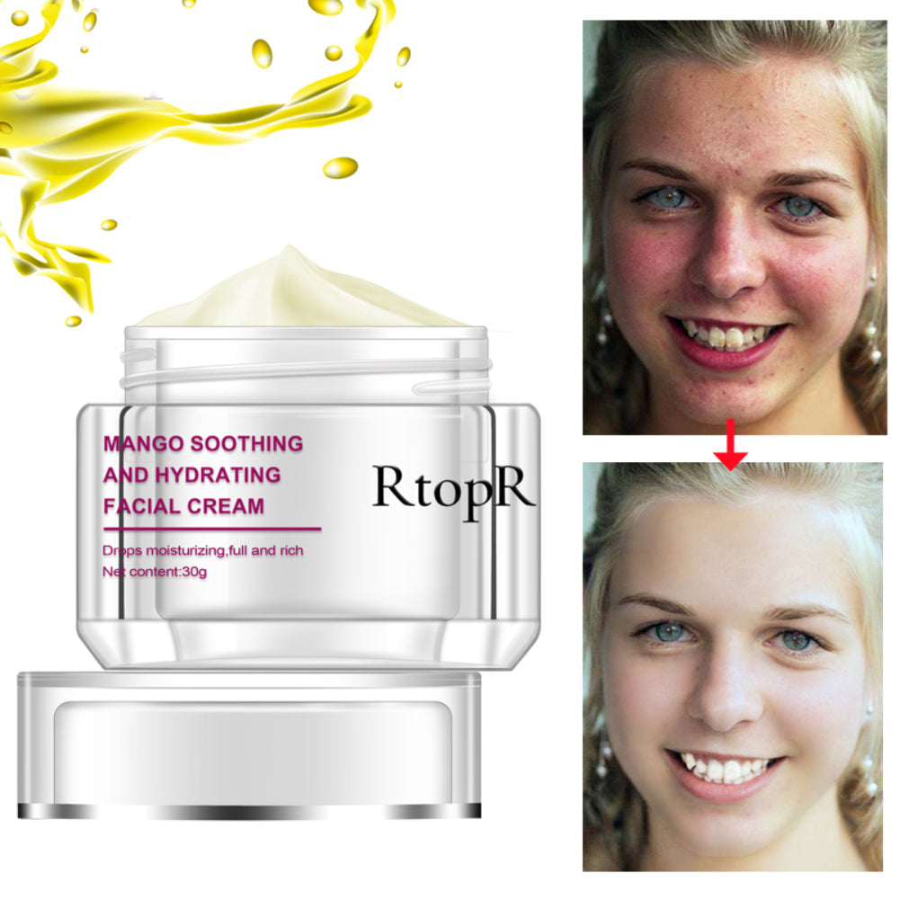 30g Mango Soothing Hydrating Skin Care Embellish Moisturizing Women Facial Cream