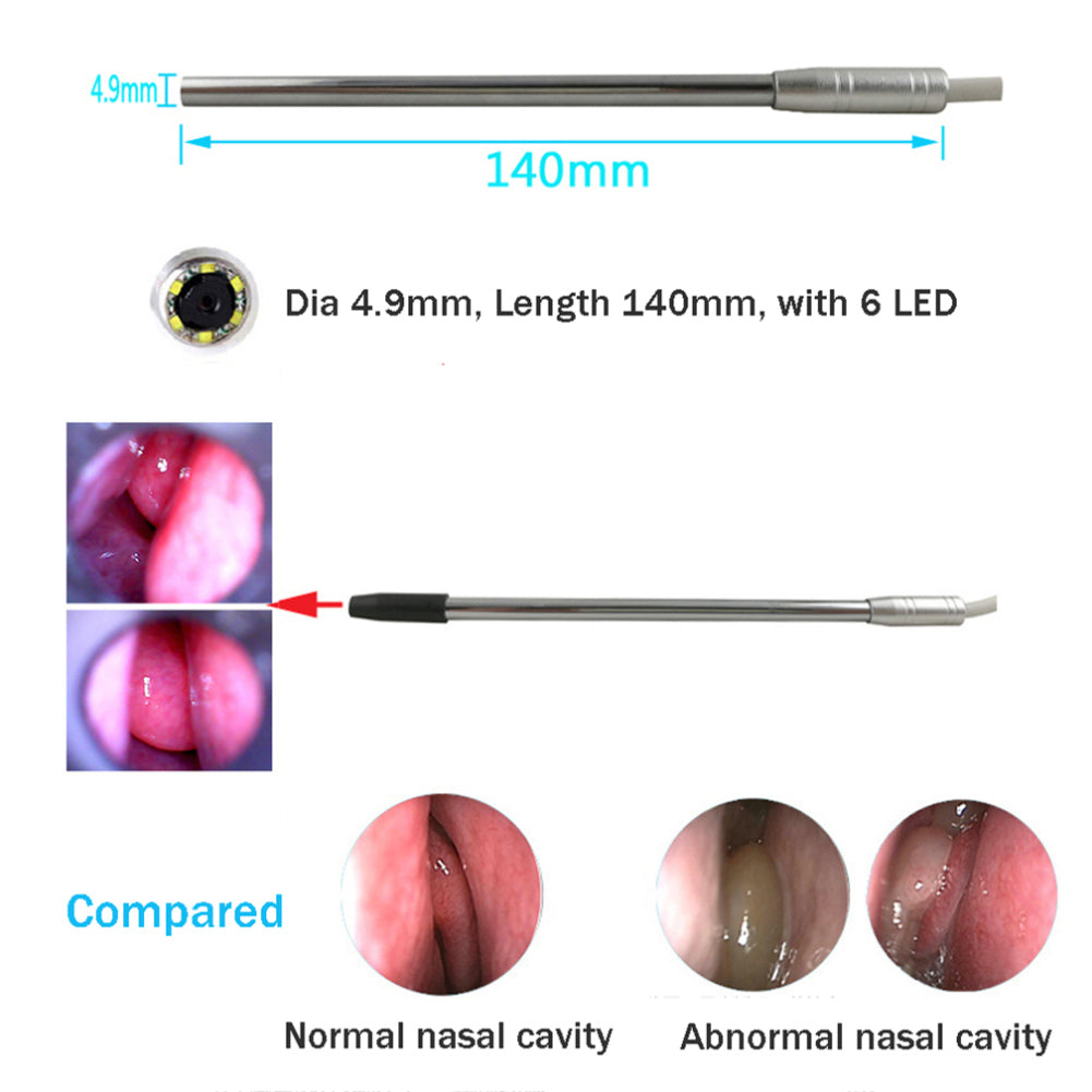 WiFi Endoscope 4.9mm Lens Ear Nose Medical Borescope Inspection Otoscope Camera