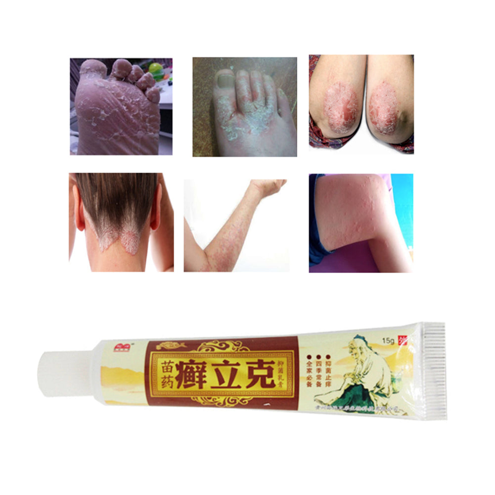 Skin Treatment Traditional Chinese Herbal Antibacterial Cream Psoriasis Ointment
