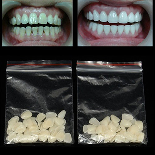 100 Pcs Ultra-thin Dental Whitening Veneers Temporary Resin Teeth Upper Anterior Slice