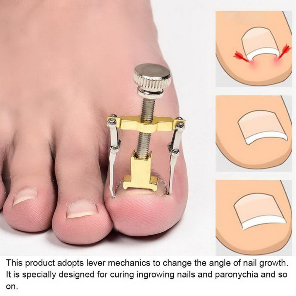 Paronychia Therapy Ingrown Toenail Lifter  and  Correction Tool Pedicure Treatment