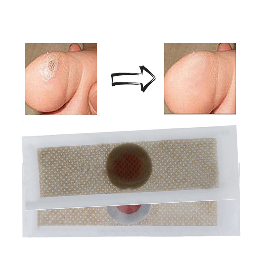 42Pcs Corn Removal Plaster Anti-Bacterial Skin Health Care Pruritus Relief Patch