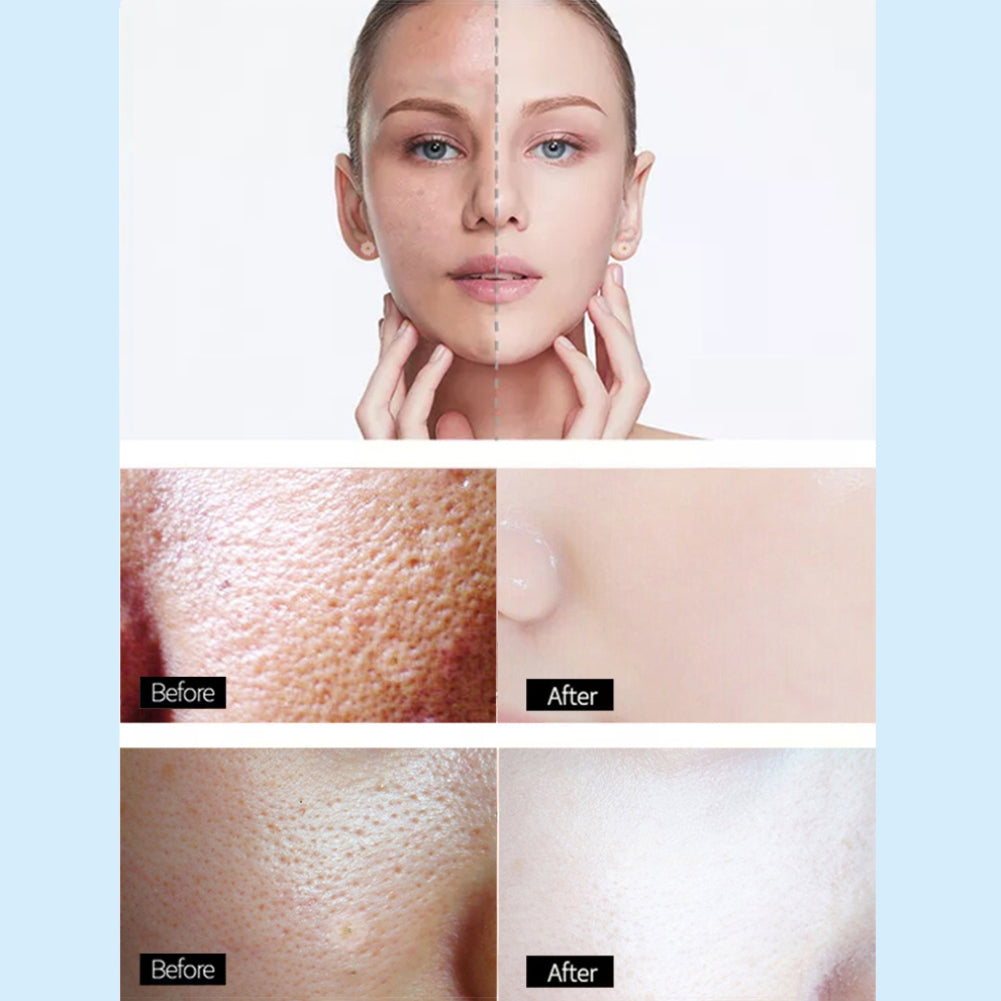 30g Mango Soothing Hydrating Skin Care Embellish Moisturizing Women Facial Cream