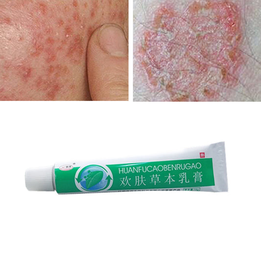 Chinese Traditional Herbal Paste Ointment Dermatitis Mosquito Bite Treatment