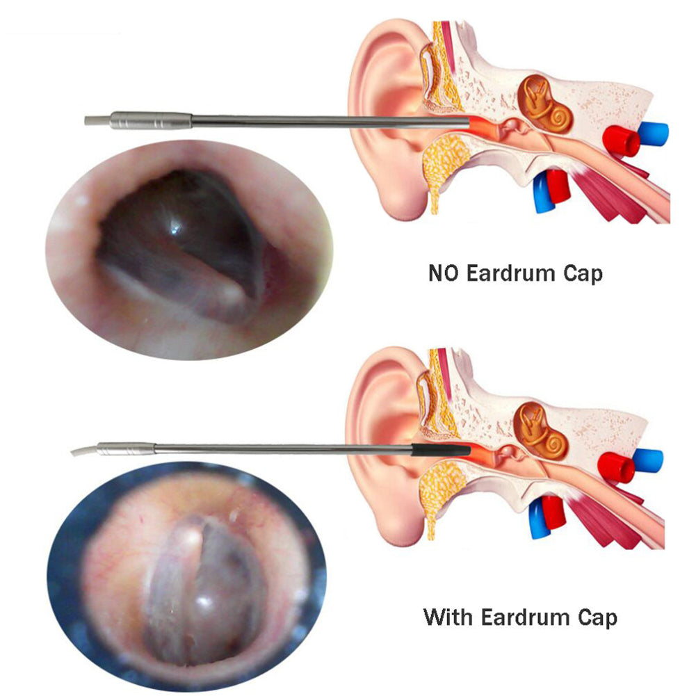 WiFi Endoscope 4.9mm Lens Ear Nose Medical Borescope Inspection Otoscope Camera