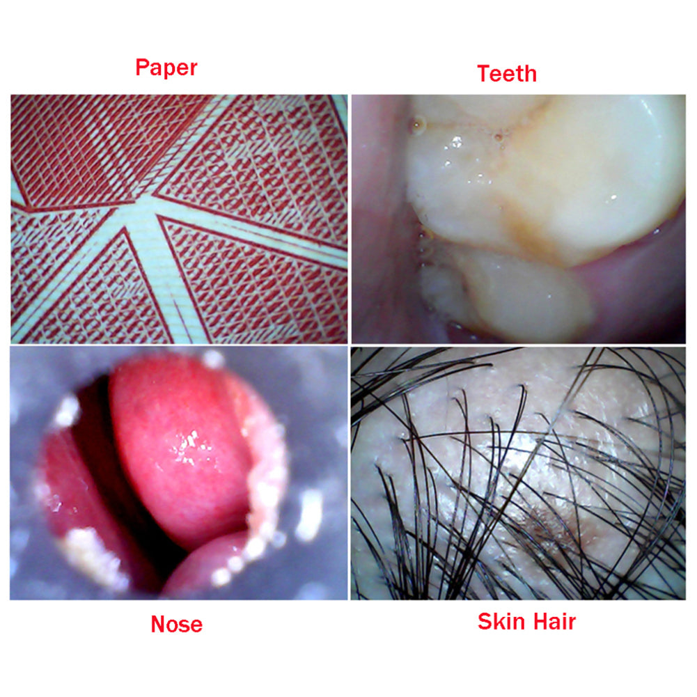 WiFi Endoscope 4.9mm Lens Ear Nose Medical Borescope Inspection Otoscope Camera