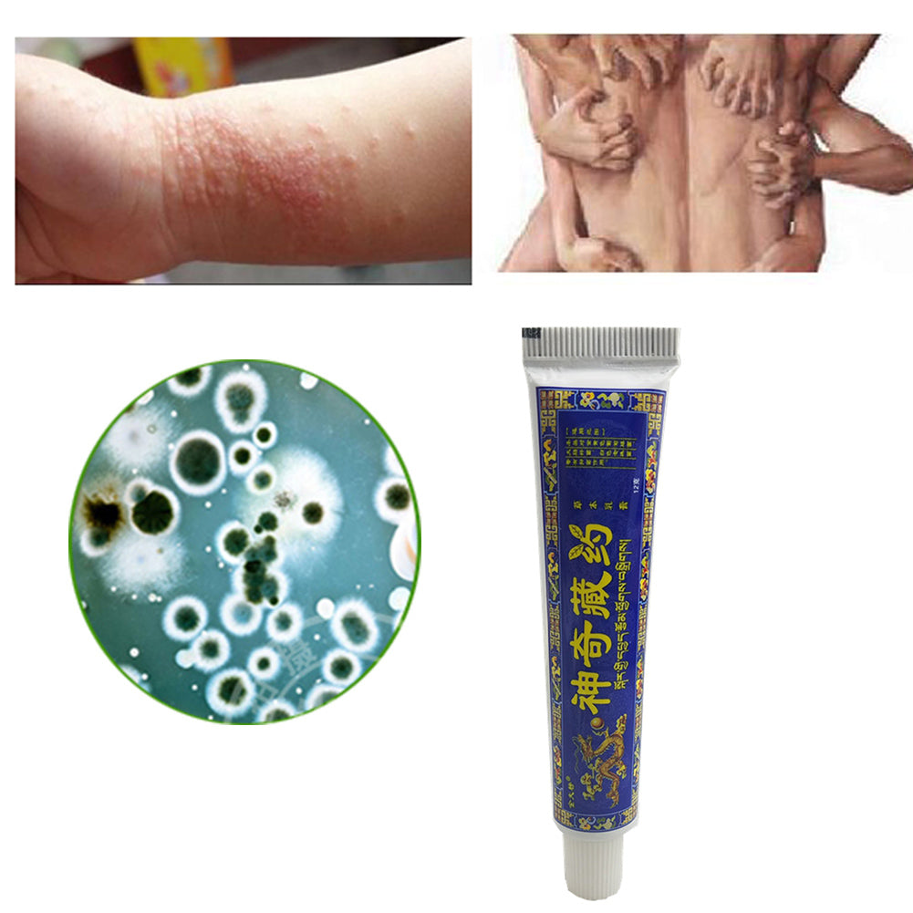 Chinese Tibetan Herbal Cream Soft Plaster Ointment Antibiosis Antiphlogosis